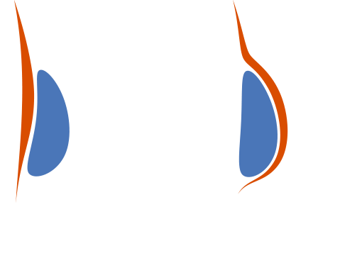 Diagram showing implants above and below the muscle